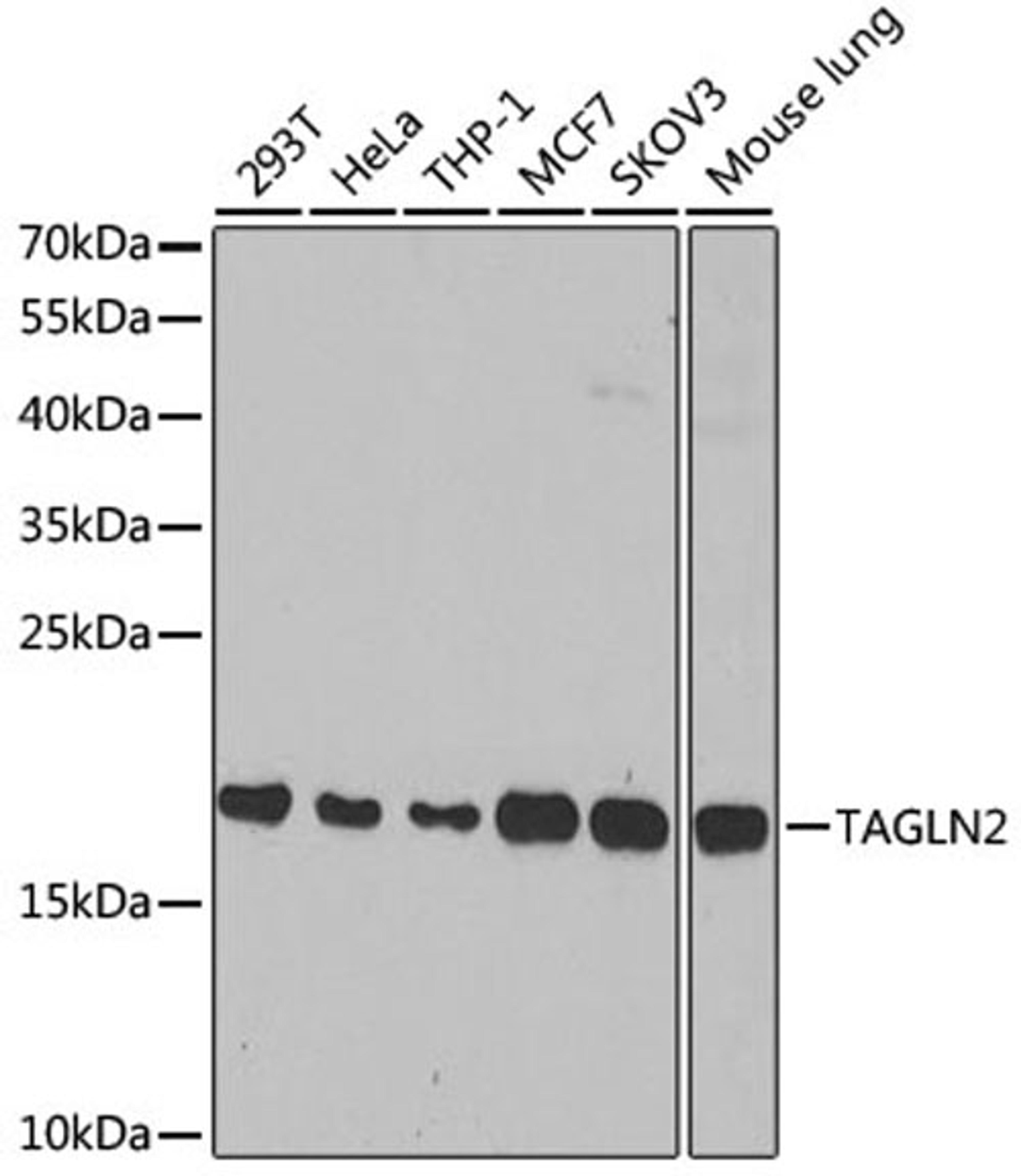 Western blot - TAGLN2 antibody (A6761)