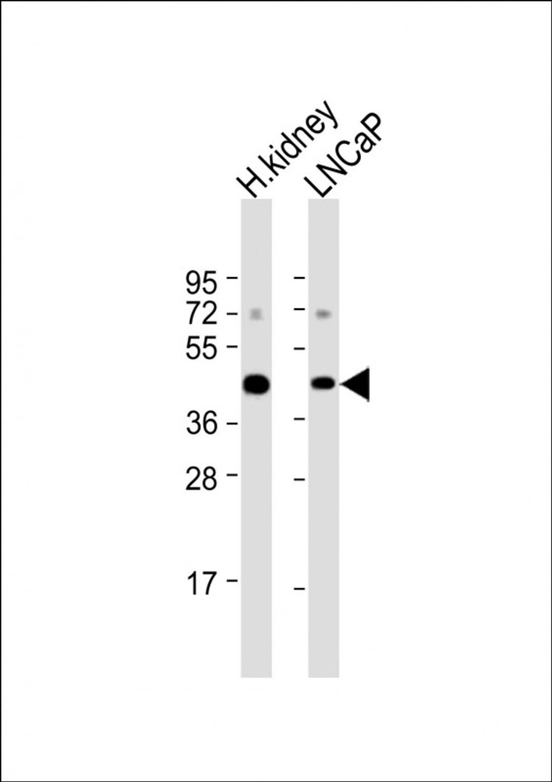 Western Blot at 1:1000 dilution Lane 1: human kidney lysate Lane 2: LNCaP whole cell lysate Lysates/proteins at 20 ug per lane.