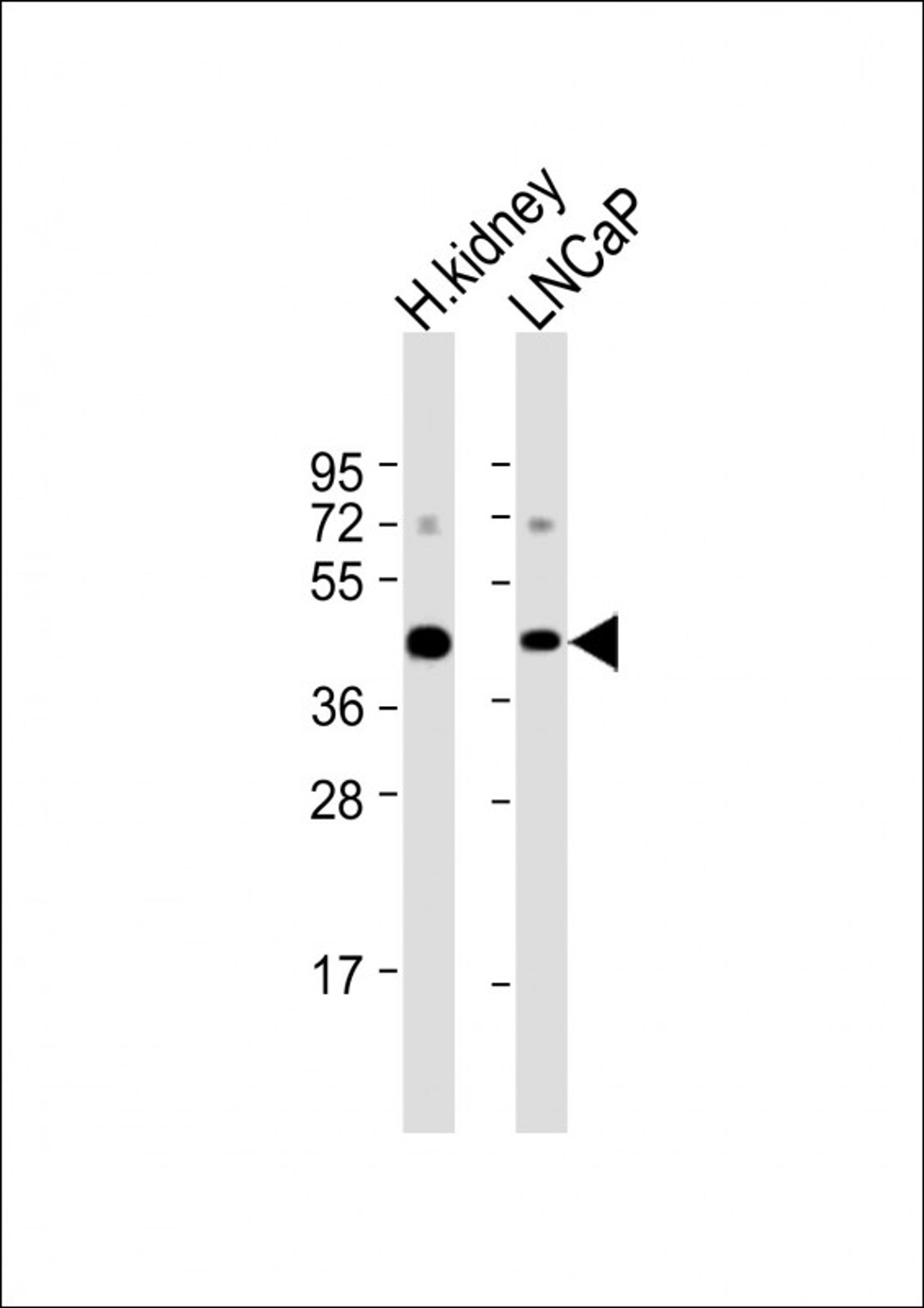 Western Blot at 1:1000 dilution Lane 1: human kidney lysate Lane 2: LNCaP whole cell lysate Lysates/proteins at 20 ug per lane.