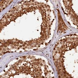 Immunohistochemistry-Paraffin: SAMD4A Antibody [NBP2-13279] - Staining of human testis shows strong cytoplasmic and nuclear positivity in cells of seminiferus ducts.