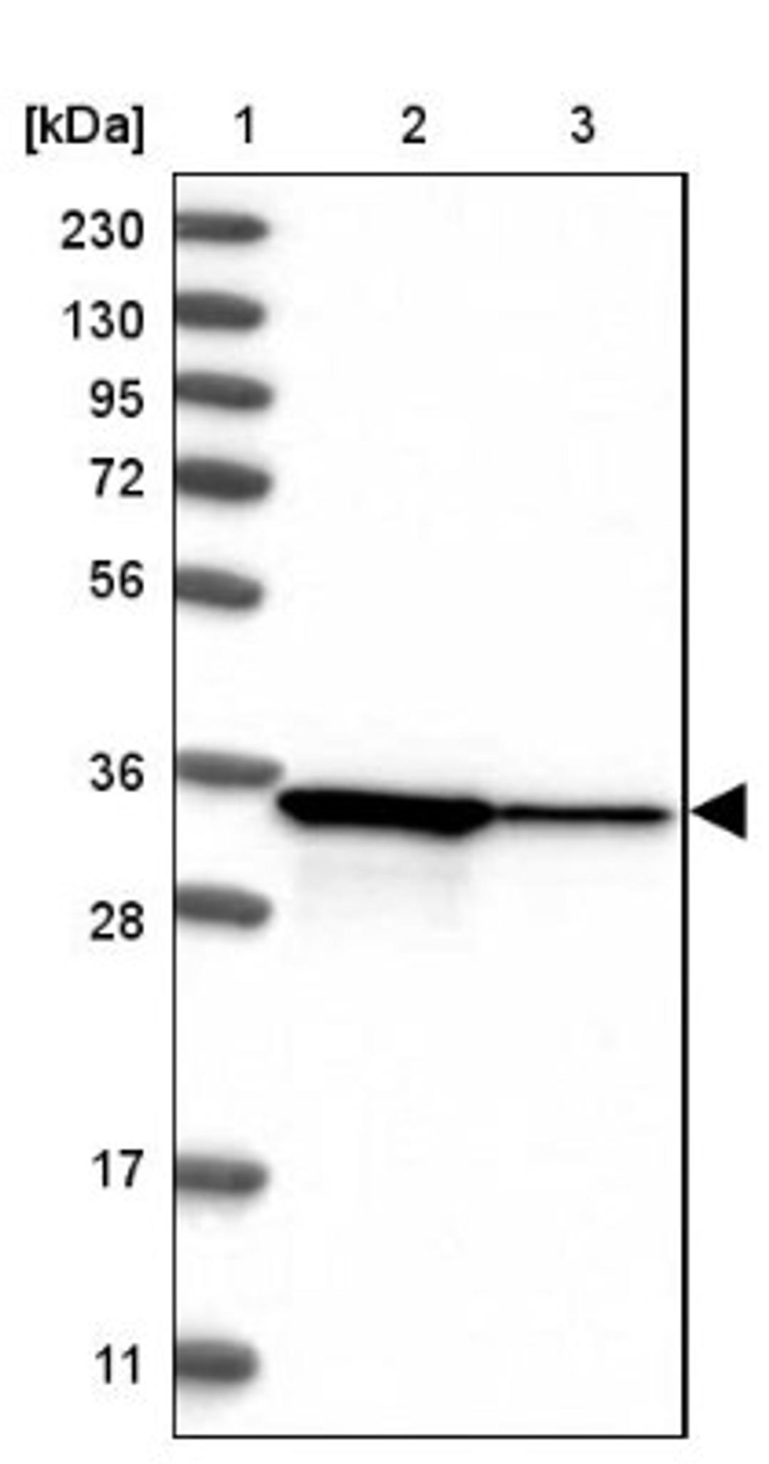 Western Blot: STARD10 Antibody [NBP1-84508] - Lane 1: Marker [kDa] 230, 130, 95, 72, 56, 36, 28, 17, 11<br/>Lane 2: Human cell line RT-4<br/>Lane 3: Human cell line U-251MG sp