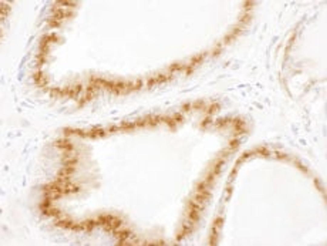 Detection of human p115 by immunohistochemistry.