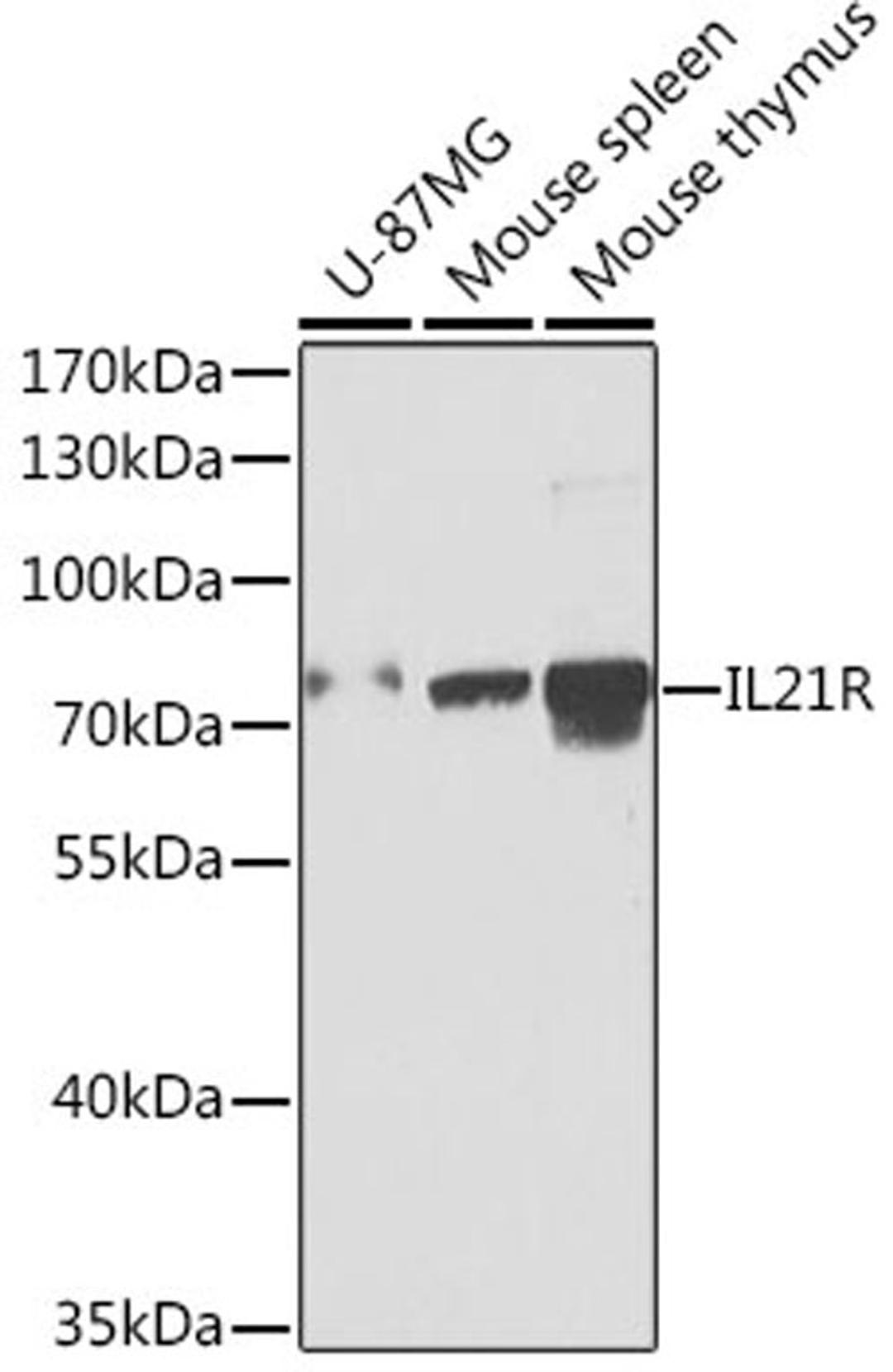 Western blot - IL21R antibody (A7468)