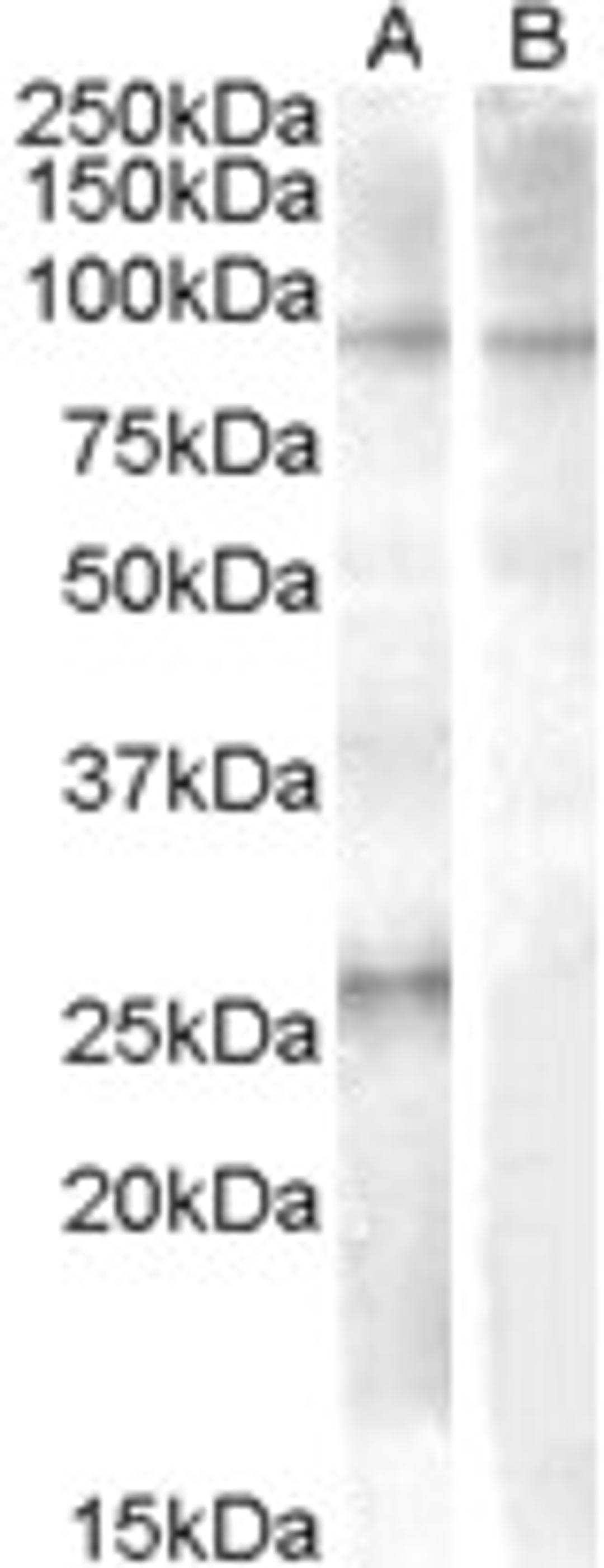 46-624 (1ug/ml) staining of Human Heart lysate (35ug protein in RIPA buffer) with (B) and without (A) blocking with the immunising peptide. Primary incubation was 1 hour. Detected by chemiluminescence.