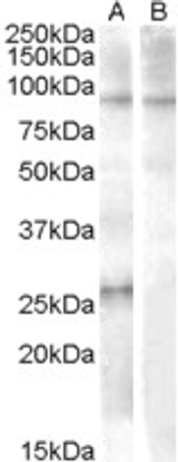 46-624 (1ug/ml) staining of Human Heart lysate (35ug protein in RIPA buffer) with (B) and without (A) blocking with the immunising peptide. Primary incubation was 1 hour. Detected by chemiluminescence.