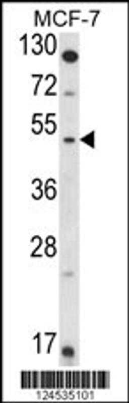 Western blot analysis of HSD11B2 Antibody in MCF-7 cell line lysates (35ug/lane)