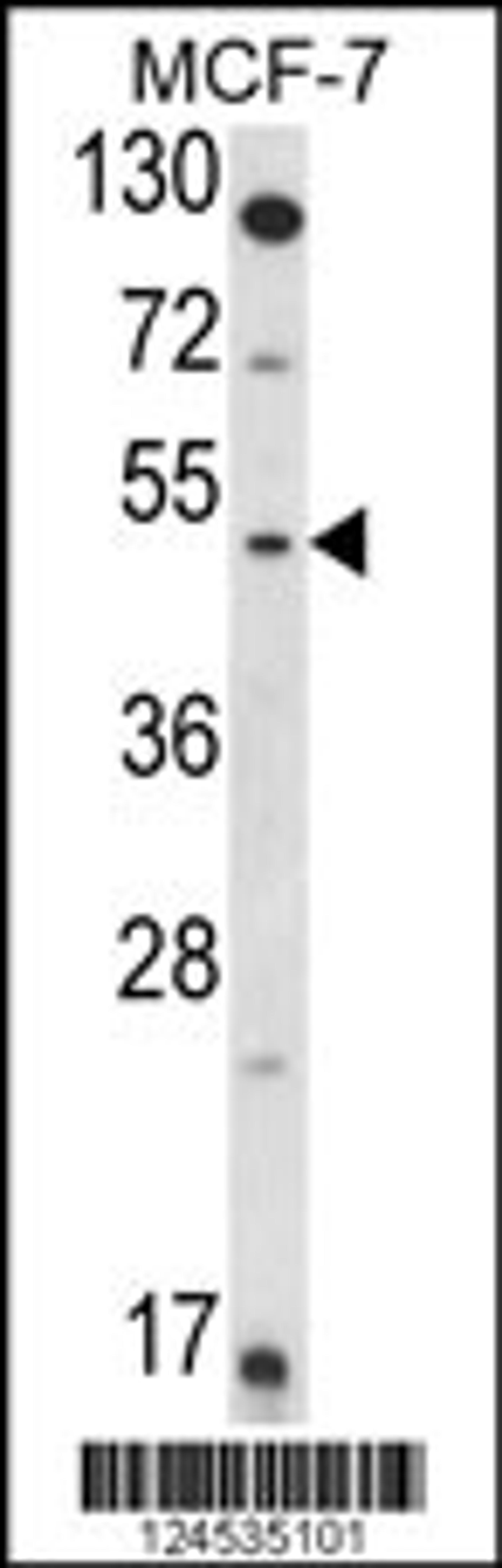 Western blot analysis of HSD11B2 Antibody in MCF-7 cell line lysates (35ug/lane)