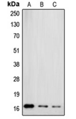 Western blot analysis of MCF7 (Lane 1), HT29 (Lane 2), HeLa (Lane 3) whole cell lysates using SNCG antibody