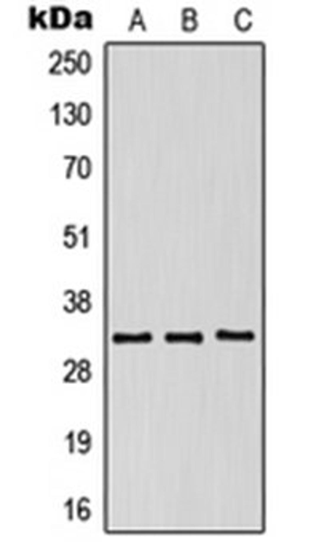 Western blot analysis of HeLa (Lane 1), SP2/0 (Lane 2), NIH3T3 (Lane 3) whole cell lysates using KIR2DS5 antibody