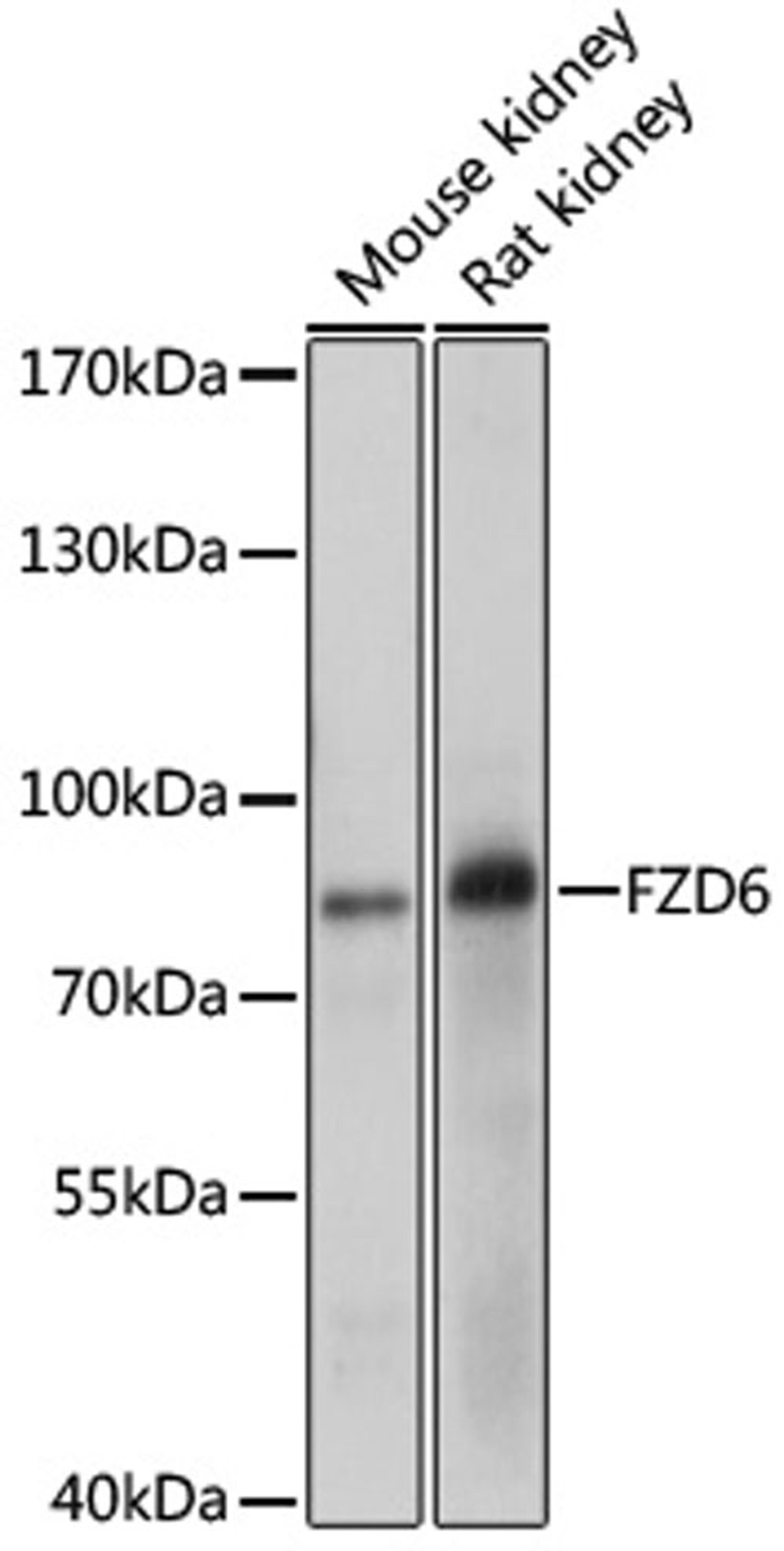 Western blot - FZD6 antibody (A10503)