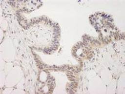 Detection of human JMJD2A by immunohistochemistry.