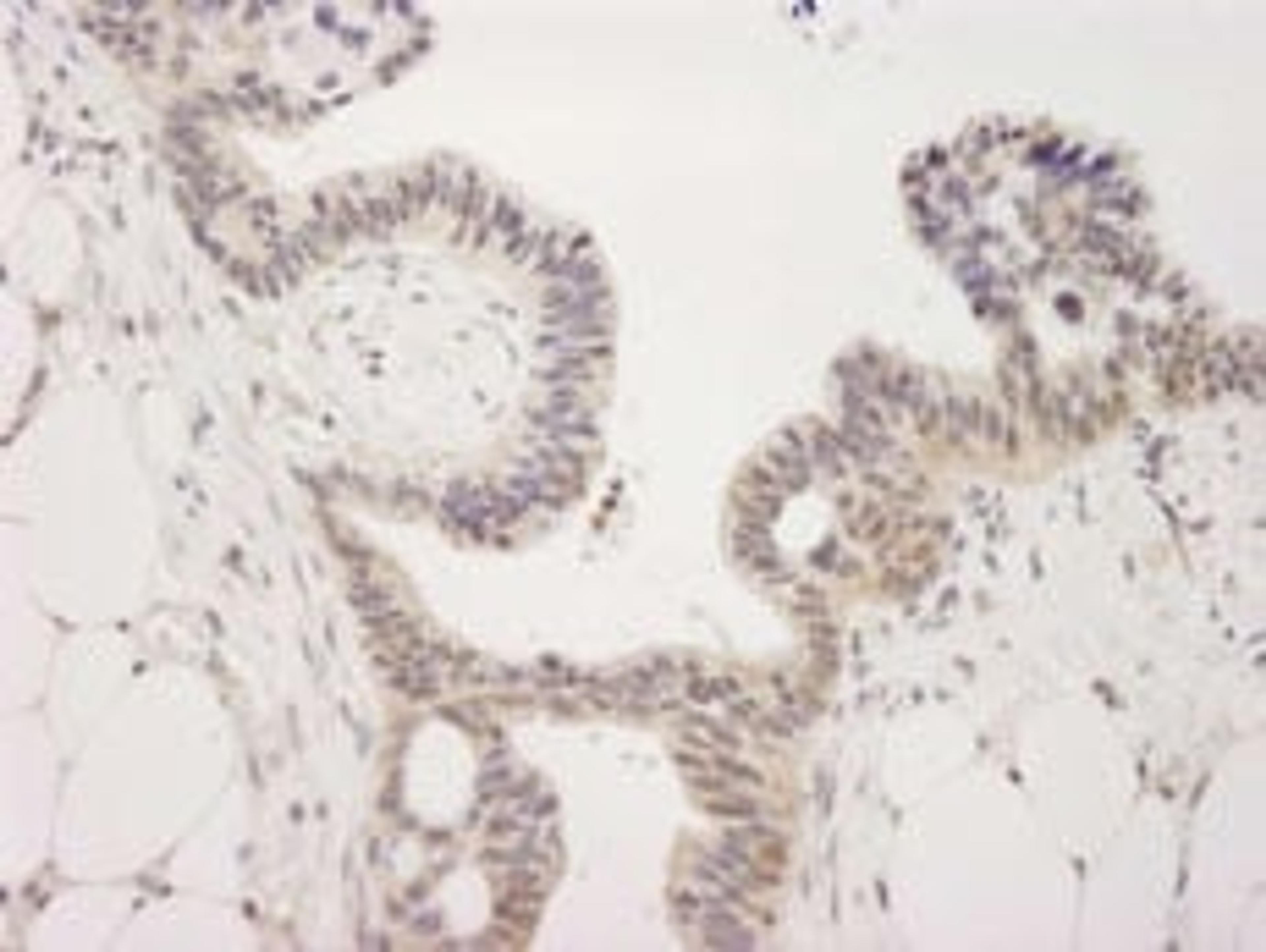 Detection of human JMJD2A by immunohistochemistry.