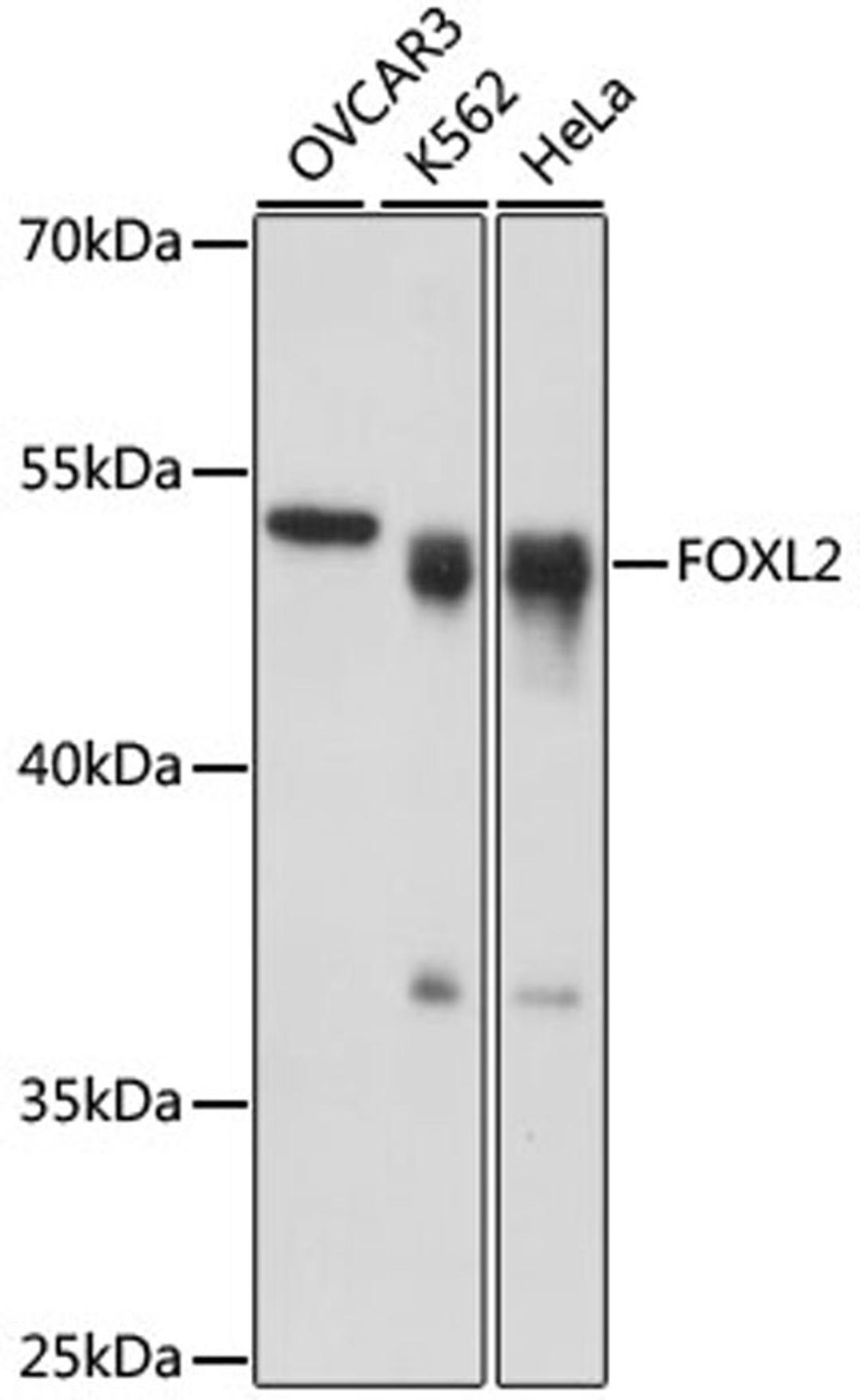 Western blot - FOXL2 antibody (A16244)