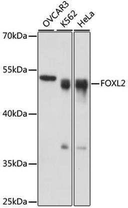 Western blot - FOXL2 antibody (A16244)