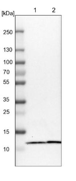 Western Blot: C7orf59 Antibody [NBP1-90936] - Lane 1: NIH-3T3 cell lysate (Mouse embryonic fibroblast cells)<br/>Lane 2: NBT-II cell lysate (Rat Wistar bladder tumour cells)