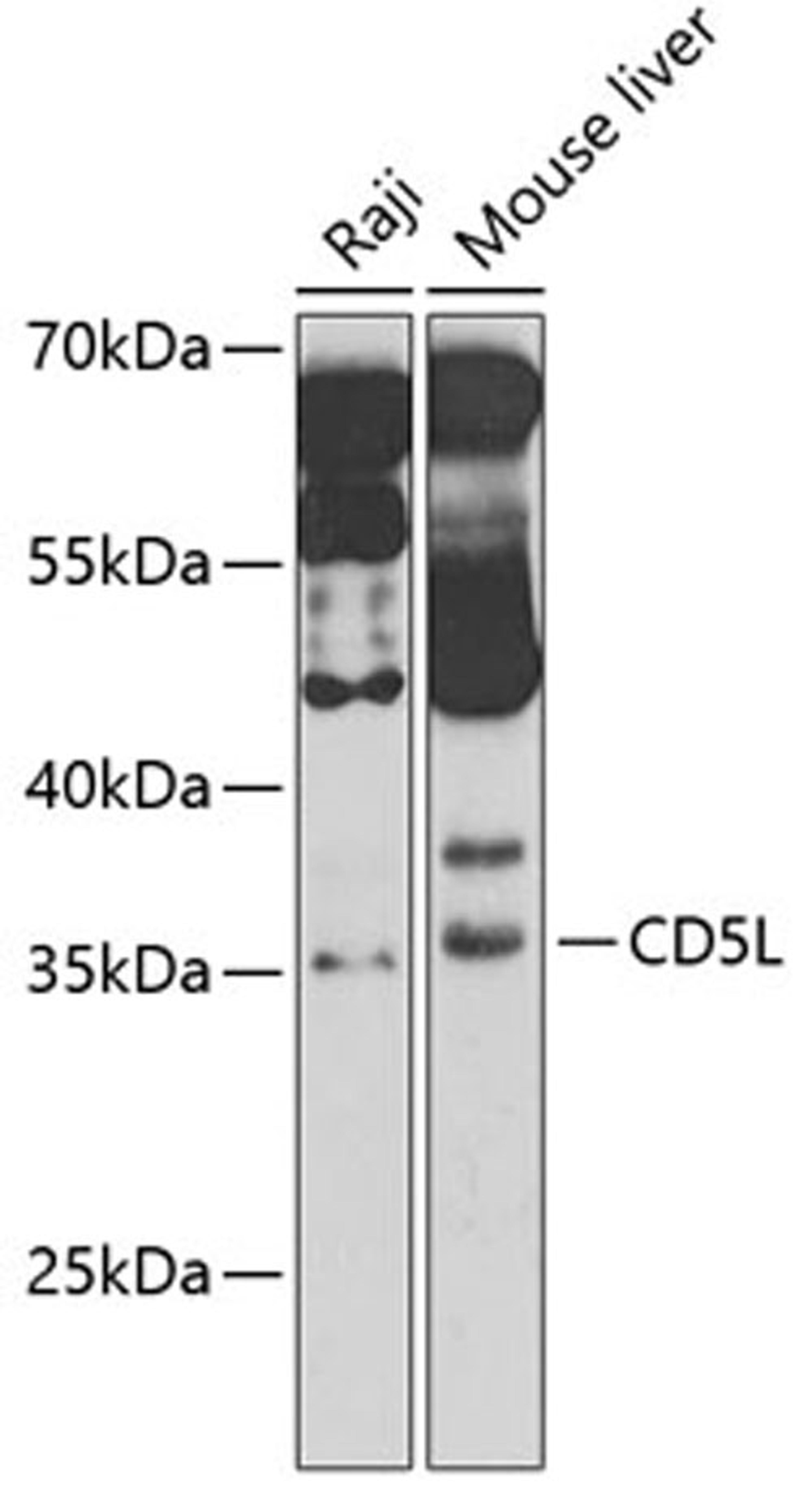 Western blot - CD5L antibody (A6223)