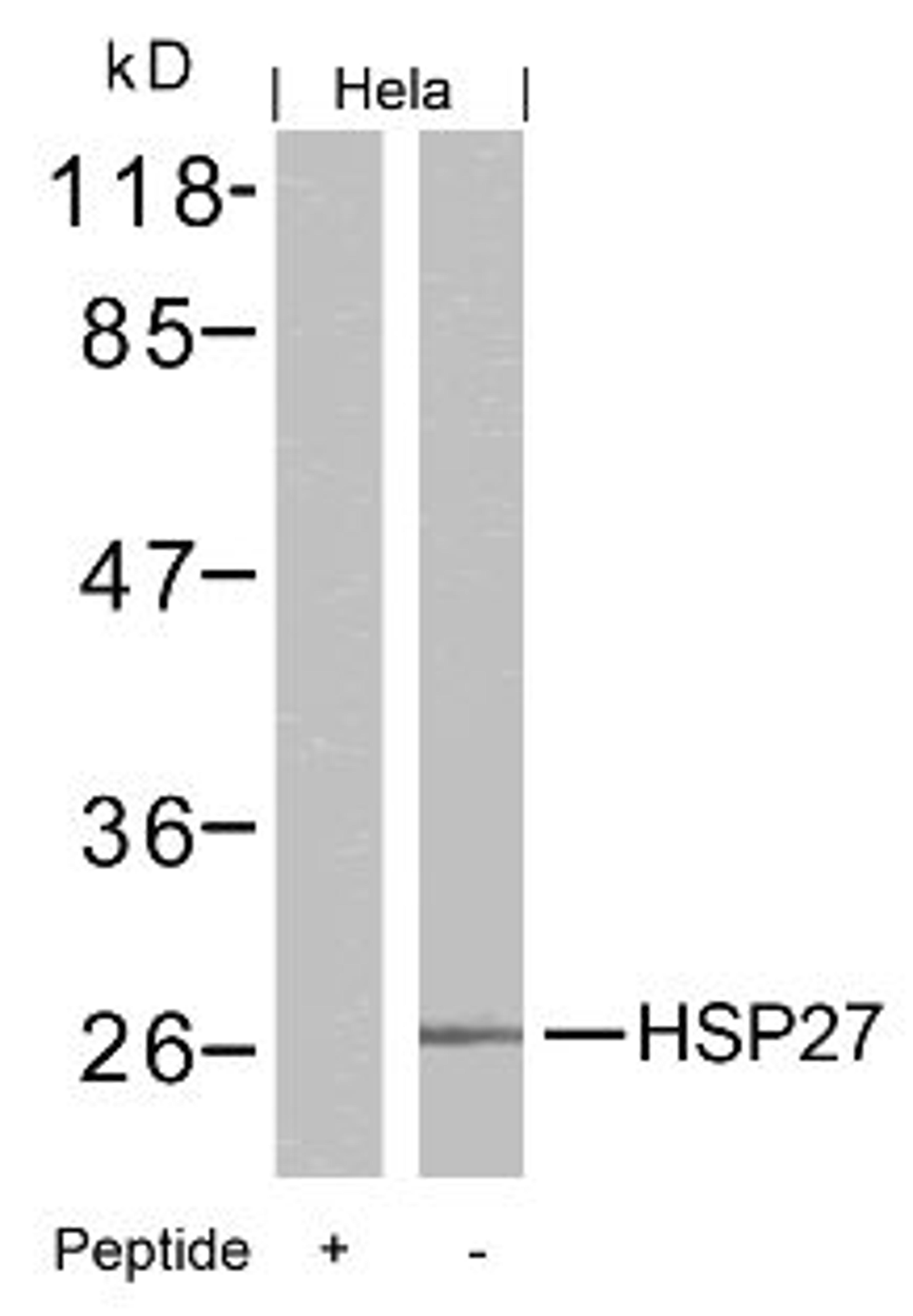 Western blot analysis of lysed extracts from HeLa cells using HSP27 (Ab-15).