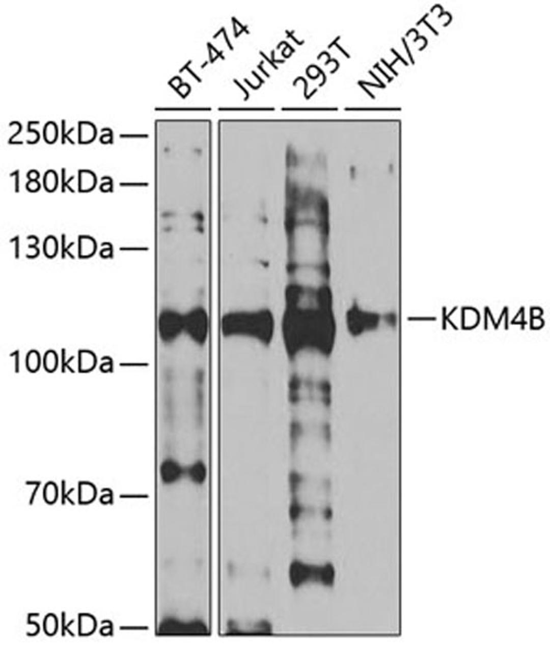 Western blot - KDM4B antibody (A5824)