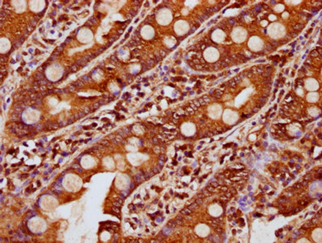 IHC image of CSB-PA769815LA01HU diluted at 1:200 and staining in paraffin-embedded human small intestine tissue performed on a Leica BondTM system. After dewaxing and hydration, antigen retrieval was mediated by high pressure in a citrate buffer (pH 6.0). Section was blocked with 10% normal goat serum 30min at RT. Then primary antibody (1% BSA) was incubated at 4&deg;C overnight. The primary is detected by a biotinylated secondary antibody and visualized using an HRP conjugated SP system.