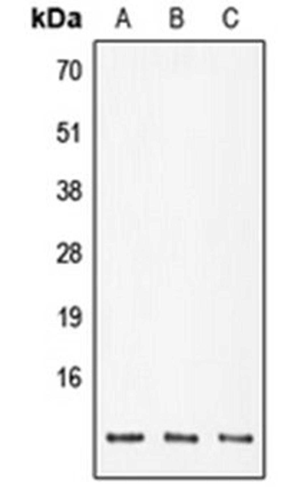 Western blot analysis of DLD (Lane 1), SP2/0 (Lane 2), PC12 (Lane 3) whole cell lysates using POLR2K antibody