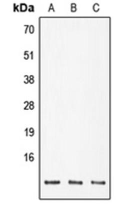 Western blot analysis of DLD (Lane 1), SP2/0 (Lane 2), PC12 (Lane 3) whole cell lysates using POLR2K antibody