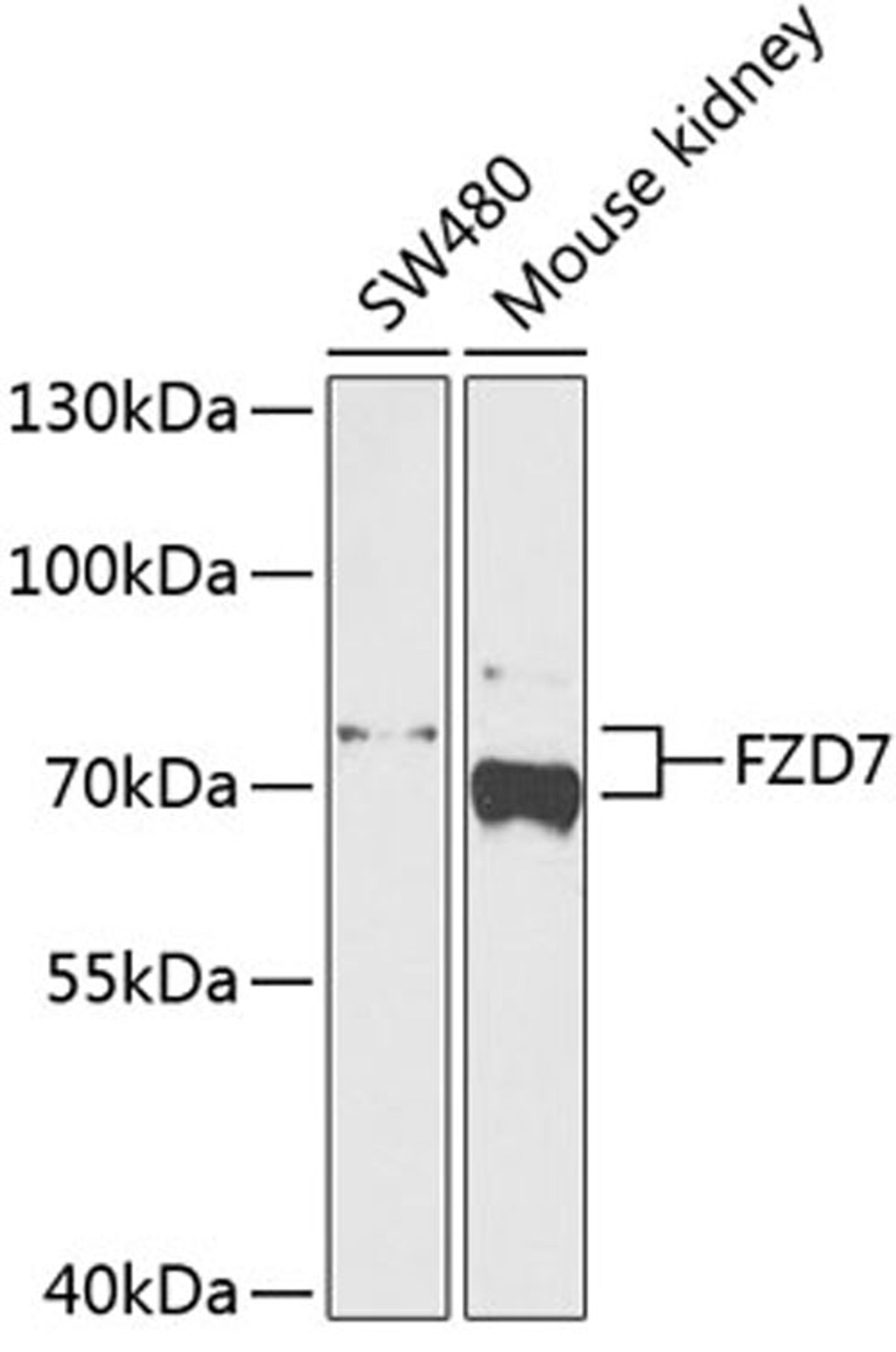 Western blot - FZD7 antibody (A4213)