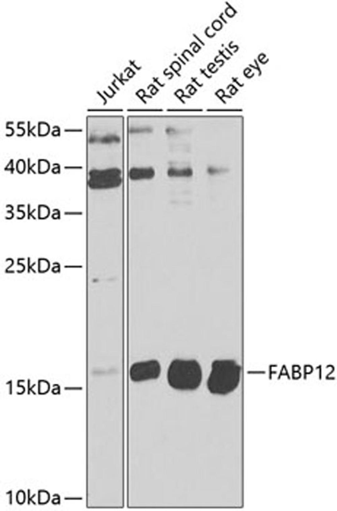 Western blot - FABP12 antibody (A9894)