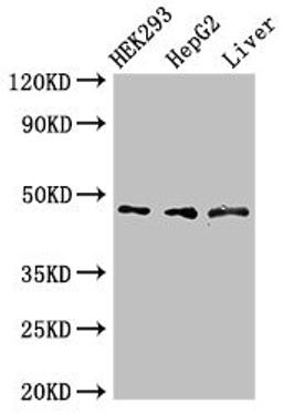 Western Blot. Positive WB detected in: HEK293 whole cell lysate, HepG2 whole cell lysate, Rat liver tissue. All lanes: ACADSB antibody at 3µg/ml. Secondary. Goat polyclonal to rabbit IgG at 1/50000 dilution. Predicted band size: 48, 37 kDa. Observed band size: 48 kDa
