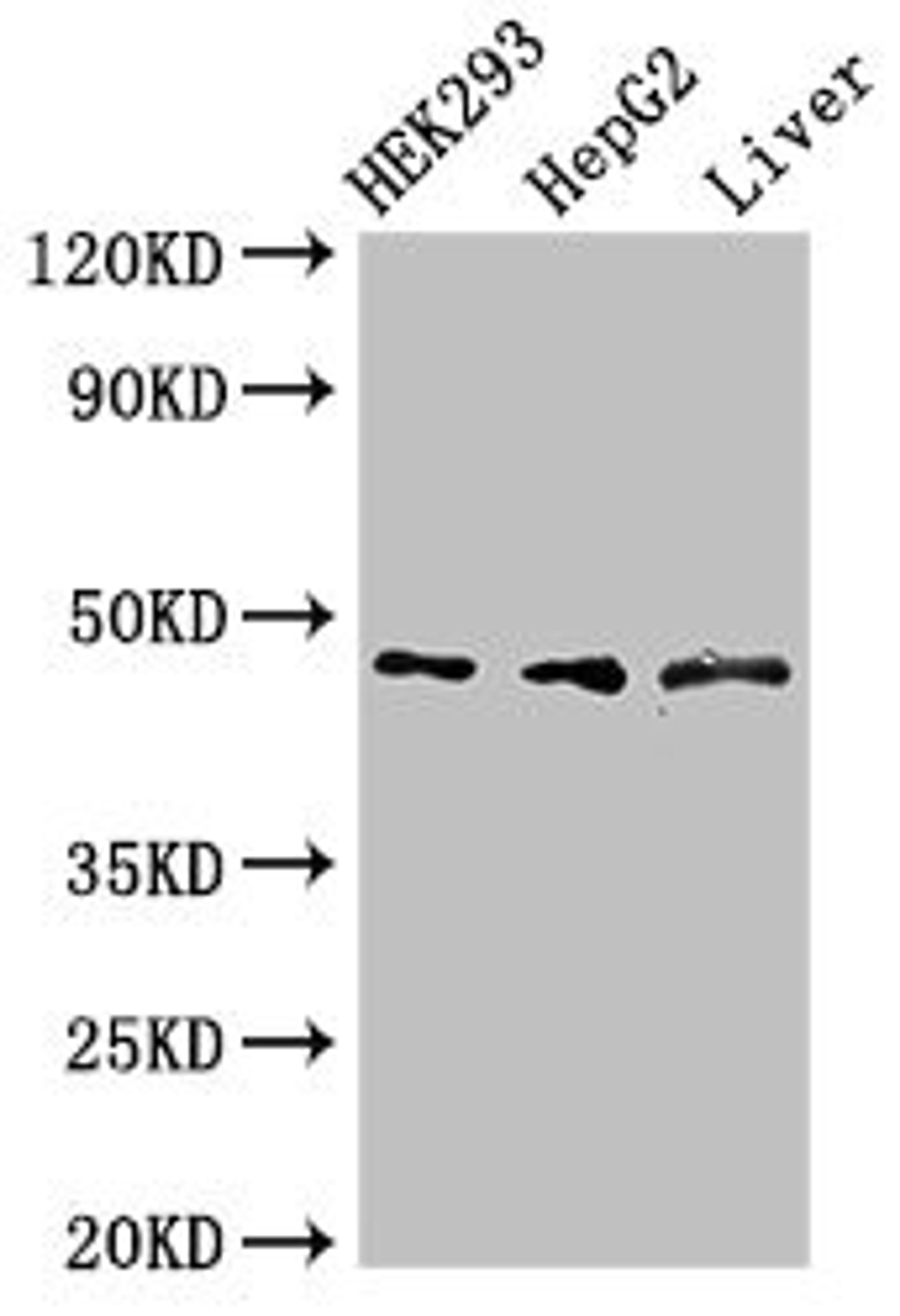 Western Blot. Positive WB detected in: HEK293 whole cell lysate, HepG2 whole cell lysate, Rat liver tissue. All lanes: ACADSB antibody at 3µg/ml. Secondary. Goat polyclonal to rabbit IgG at 1/50000 dilution. Predicted band size: 48, 37 kDa. Observed band size: 48 kDa