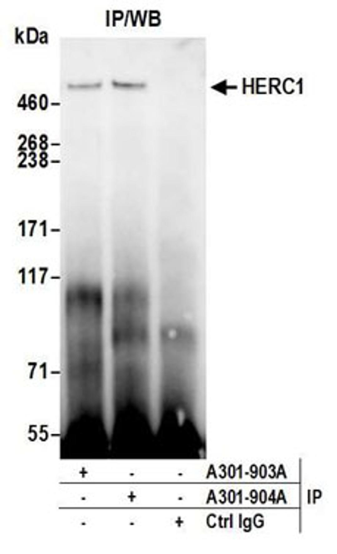 Detection of human HERC1 by western blot of immunoprecipitates.