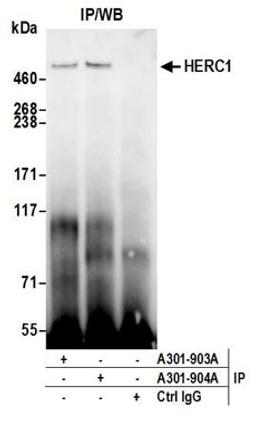 Detection of human HERC1 by western blot of immunoprecipitates.