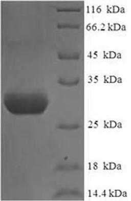 (Tris-Glycine gel) Discontinuous SDS-PAGE (reduced) with 5% enrichment gel and 15% separation gel.