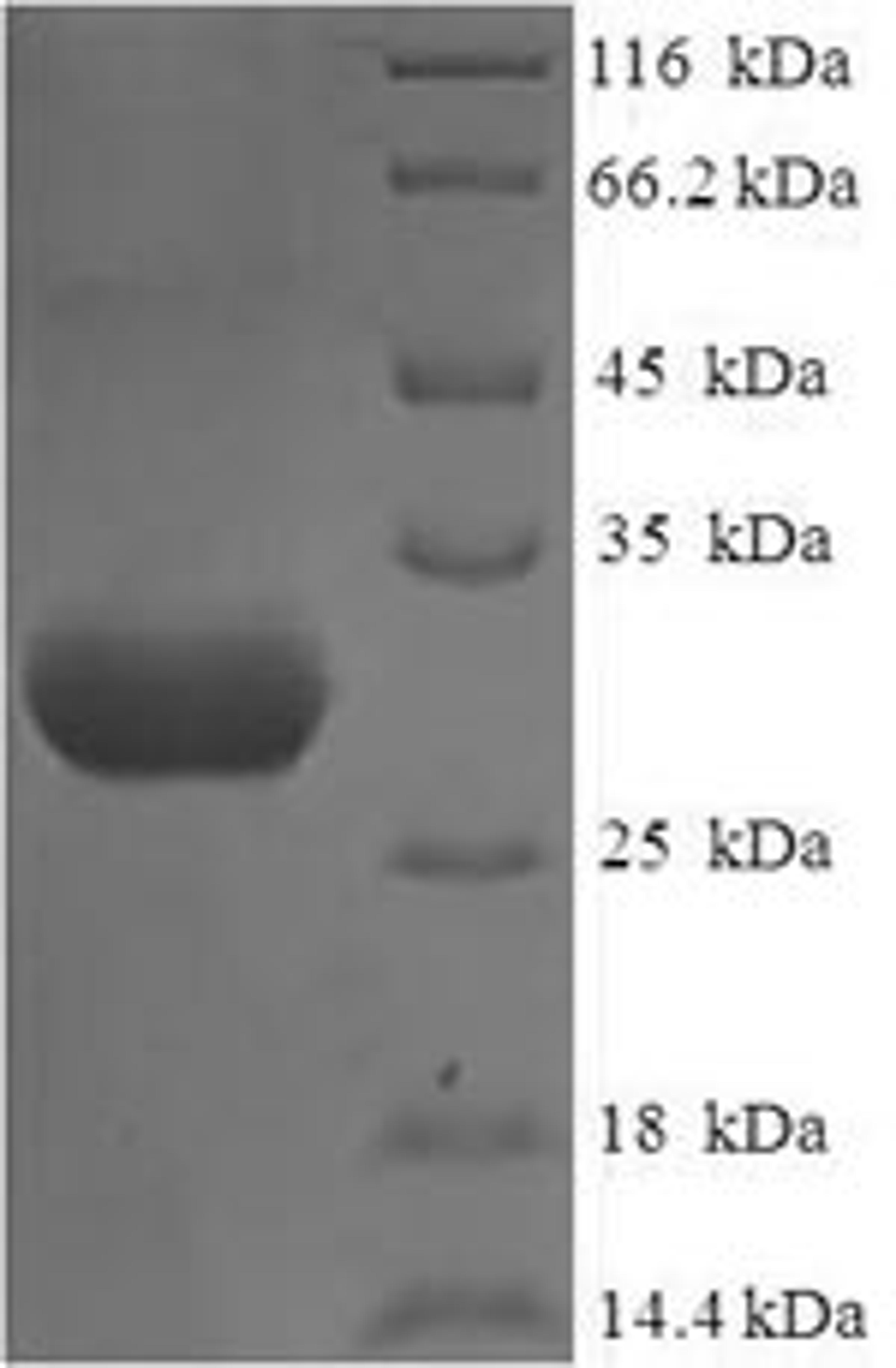 (Tris-Glycine gel) Discontinuous SDS-PAGE (reduced) with 5% enrichment gel and 15% separation gel.