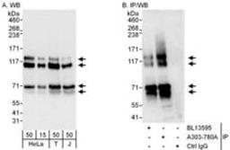 Detection of human MAP7D1 by western blot and immunoprecipitation.