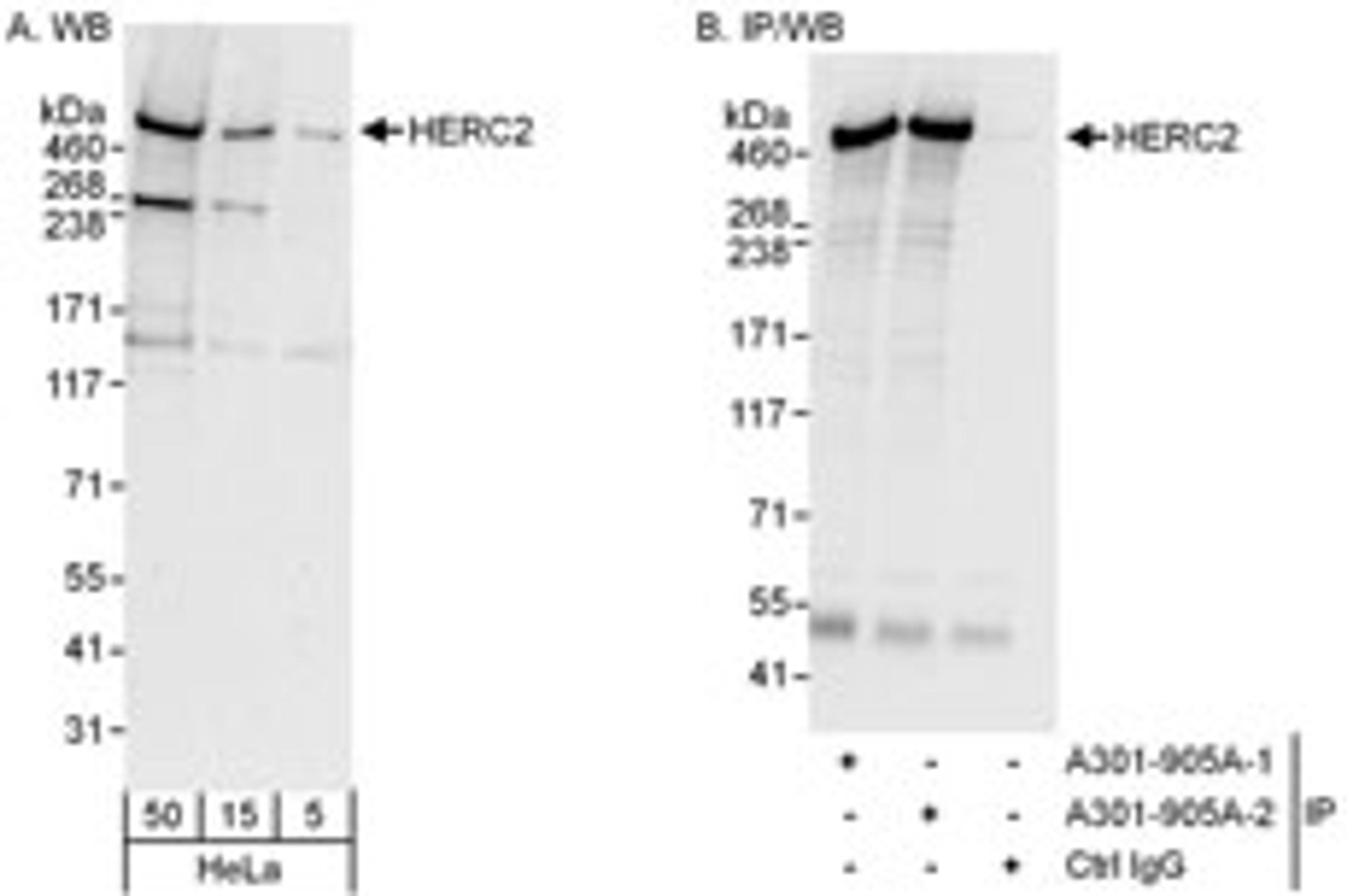 Detection of human HERC2 by western blot and immunoprecipitation.