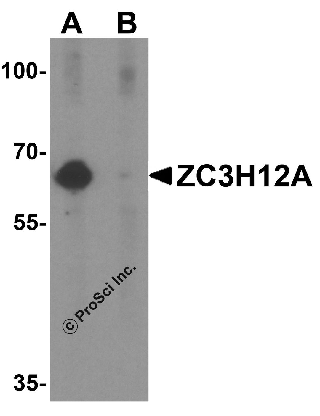 Western blot analysis of ZC3H12A in K562 cell lysate with ZC3H12A antibody at 1 μg/mL in (A) the absence and (B) the presence of blocking peptide.