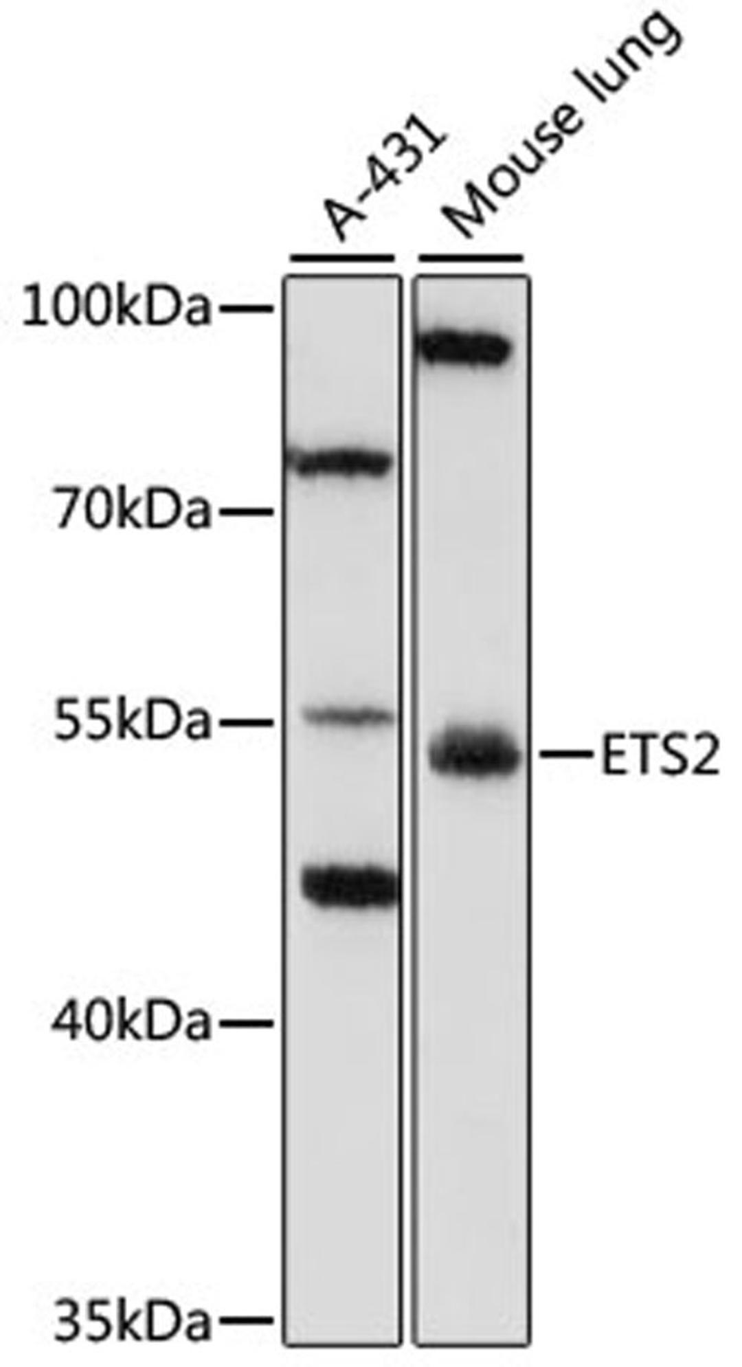 Western blot - SPRY3 antibody (A7329)