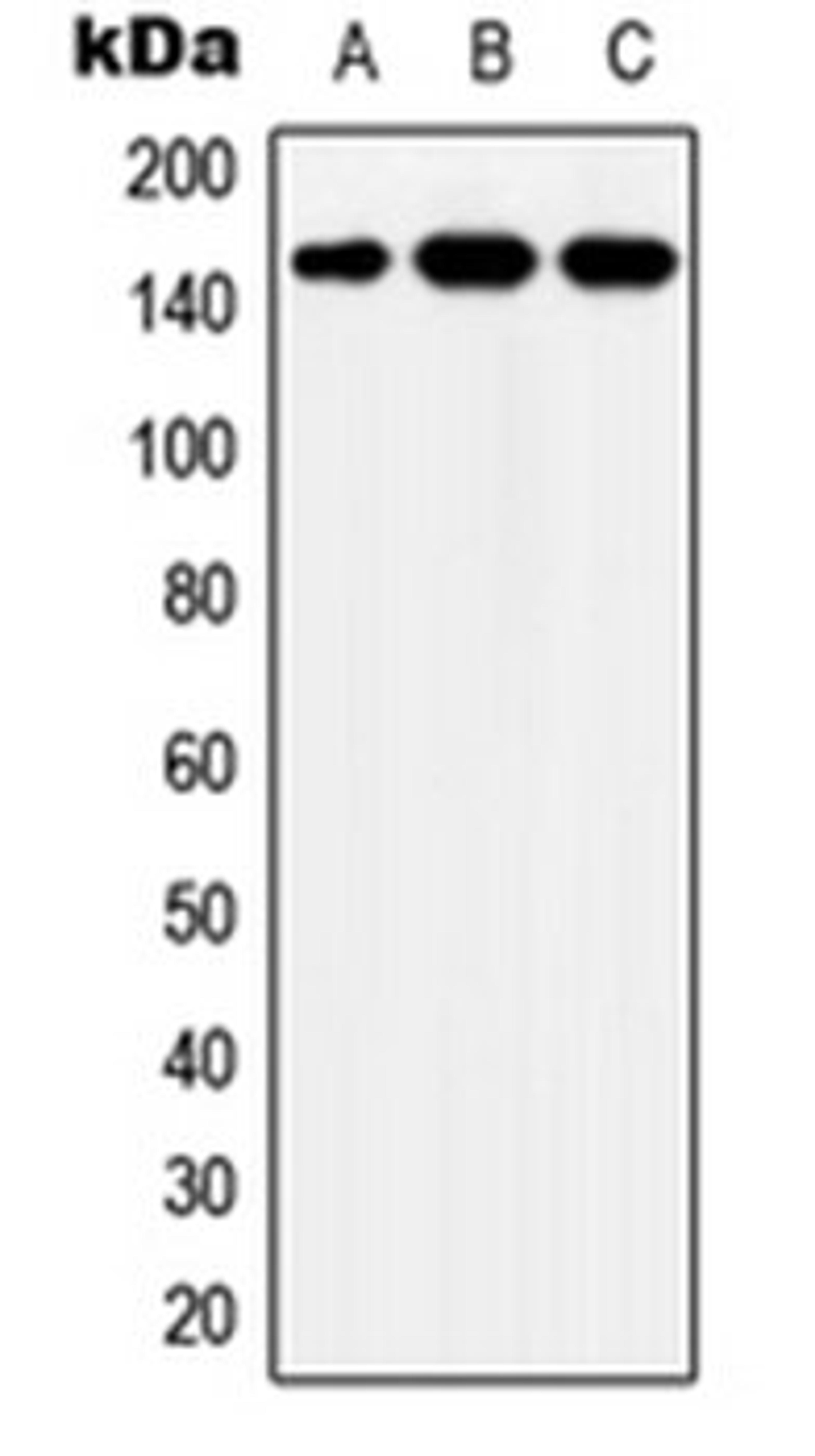 Western blot analysis of MCF7 (Lane 1), SP2/0 (Lane 2), HeLa (Lane 3) whole cell lysates using YEATS2 antibody