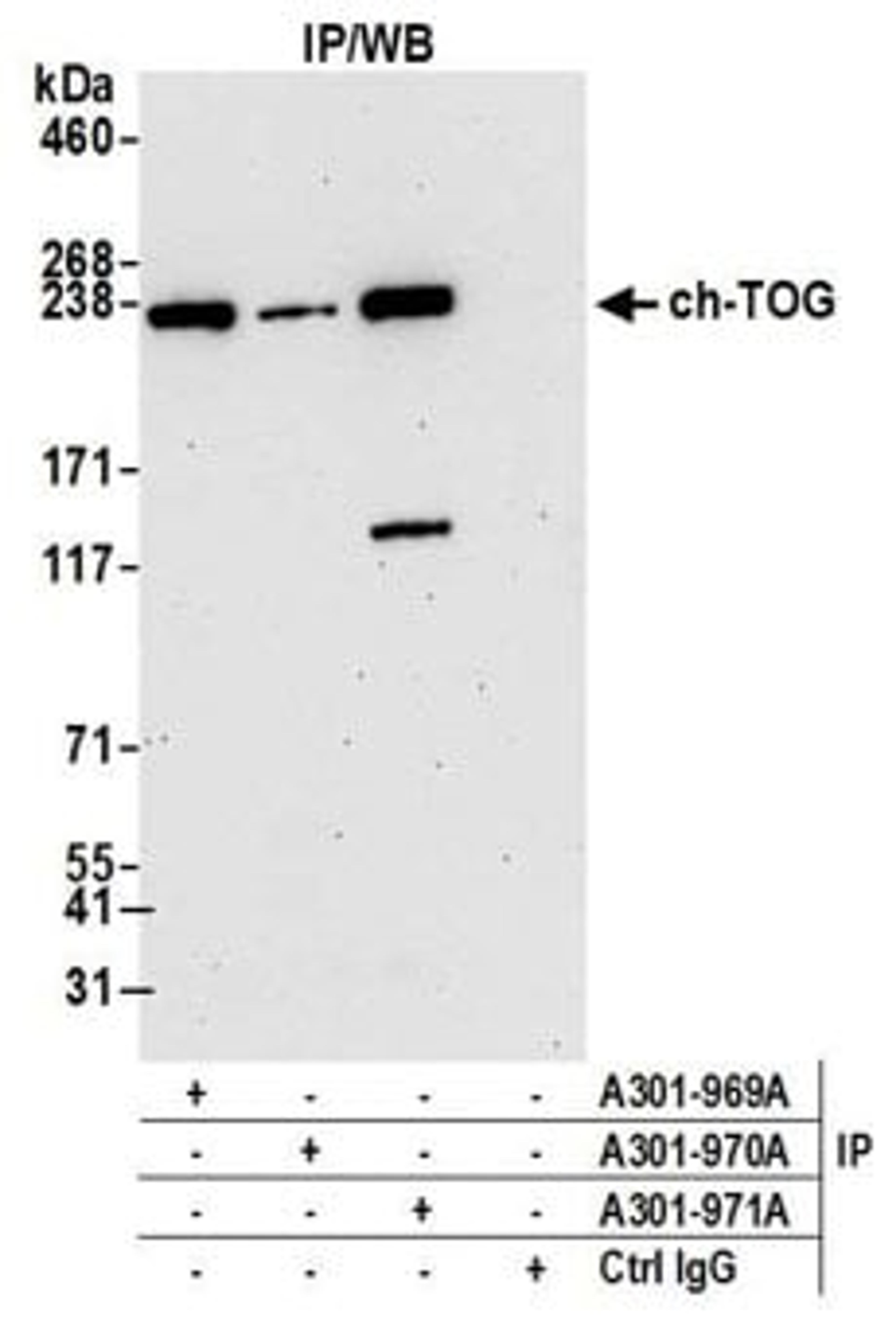 Detection of human ch-TOG by western blot of immunoprecipitates.