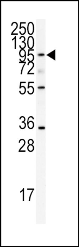 Western blot analysis of anti-ADAMTS13 Antibody in CEM cell line lysates (35ug/lane)