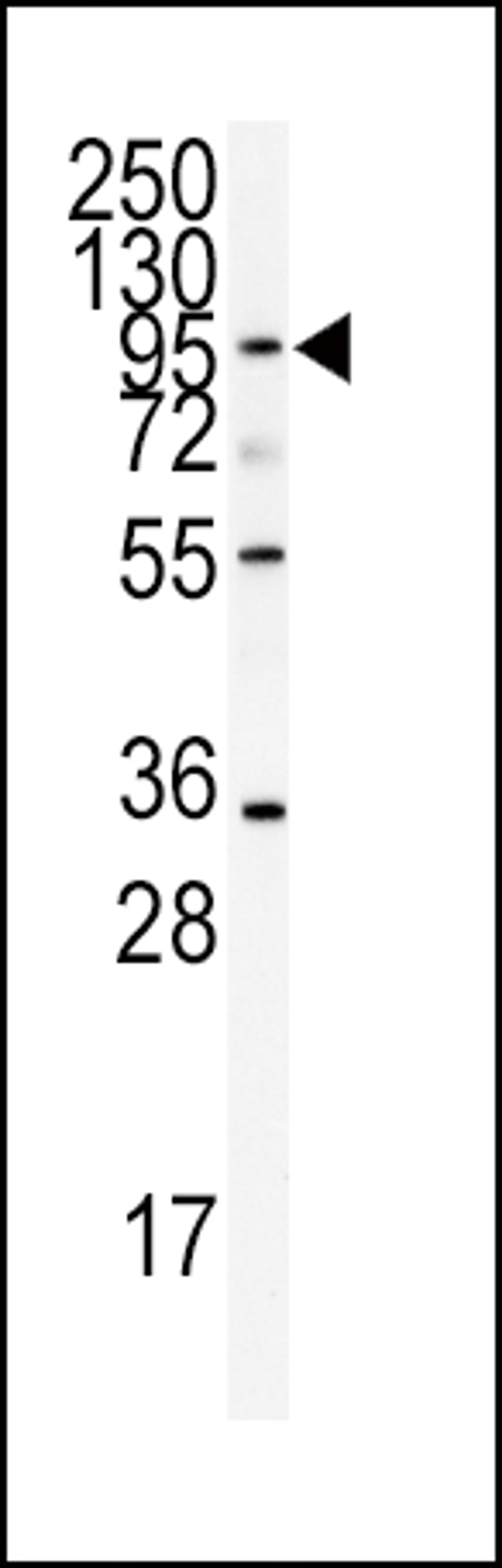 Western blot analysis of anti-ADAMTS13 Antibody in CEM cell line lysates (35ug/lane)