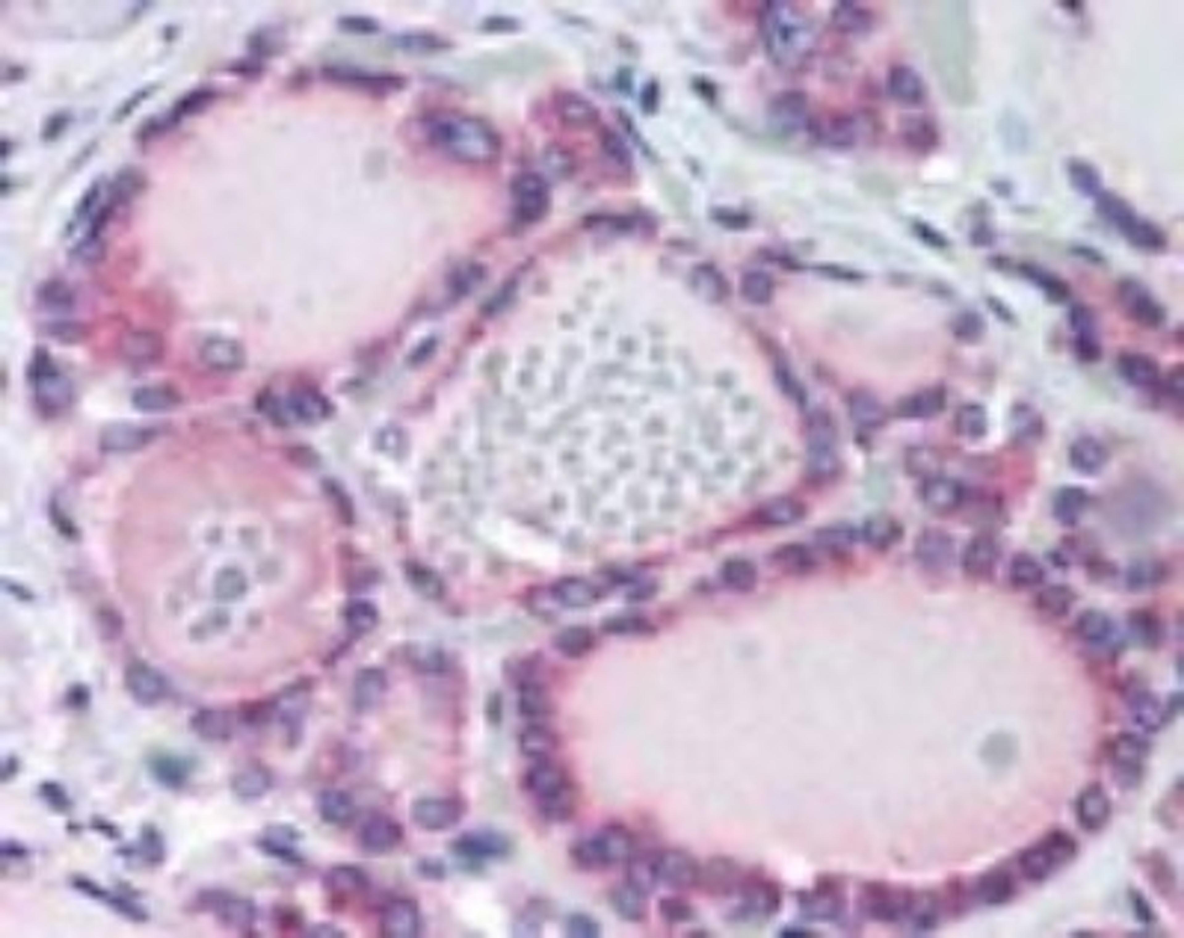 Immunohistochemistry-Paraffin: Thyrotropin-Releasing Hormone Receptor Antibody [NBP2-24726] - Staining of human thyroid using this antibody at 10 ug/ml.