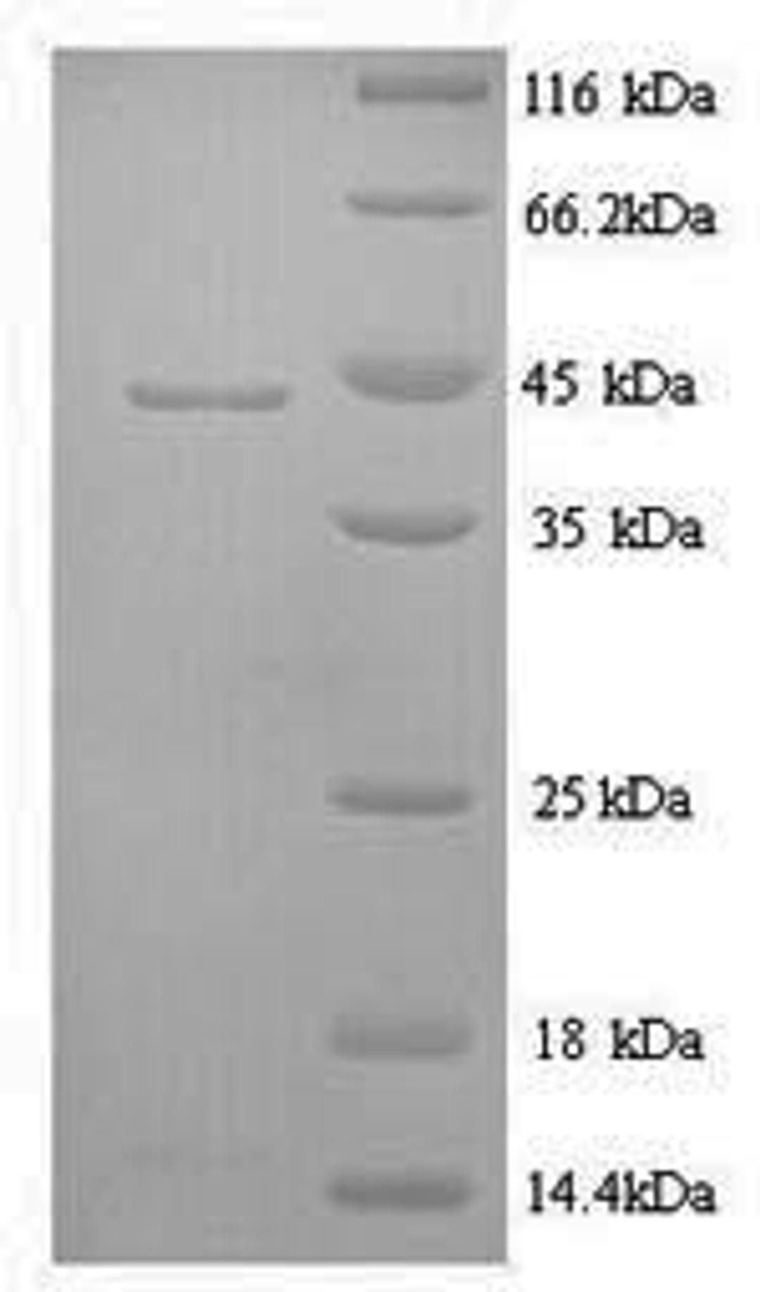 (Tris-Glycine gel) Discontinuous SDS-PAGE (reduced) with 5% enrichment gel and 15% separation gel.