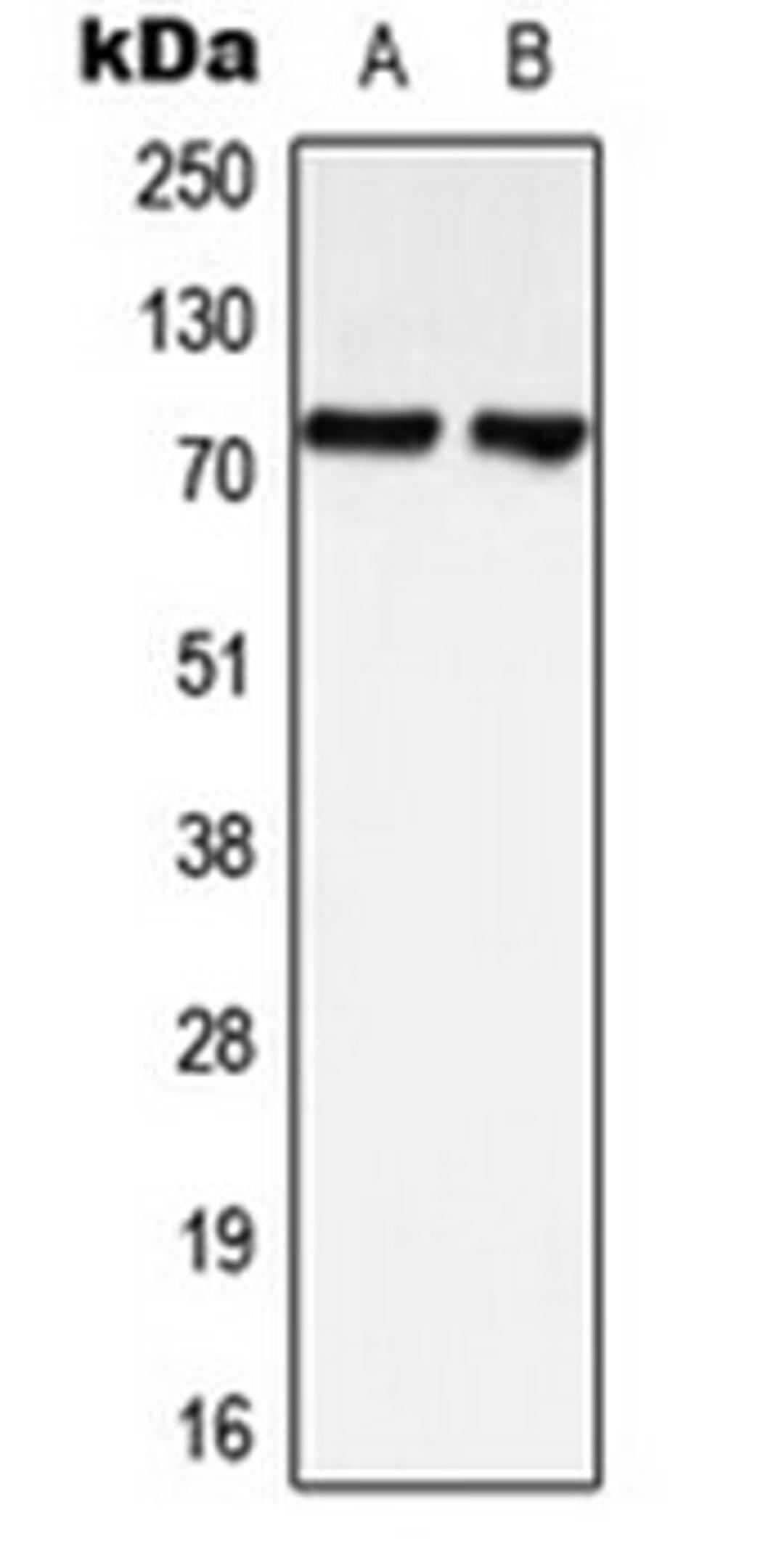 Western blot analysis of HeLa (Lane 1), SHSY5Y (Lane 2) whole cell lysates using LIMK1; LIMK2 antibody