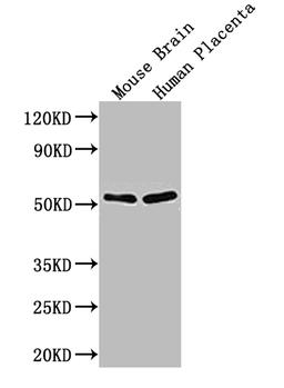 Western Blot. Positive WB detected in: Mouse brain tissue, Human placenta tissue. All lanes: ADRB1 antibody at 3ug/ml. Secondary. Goat polyclonal to rabbit IgG at 1/50000 dilution. Predicted band size: 52 kDa. Observed band size: 52, 48 kDa. 