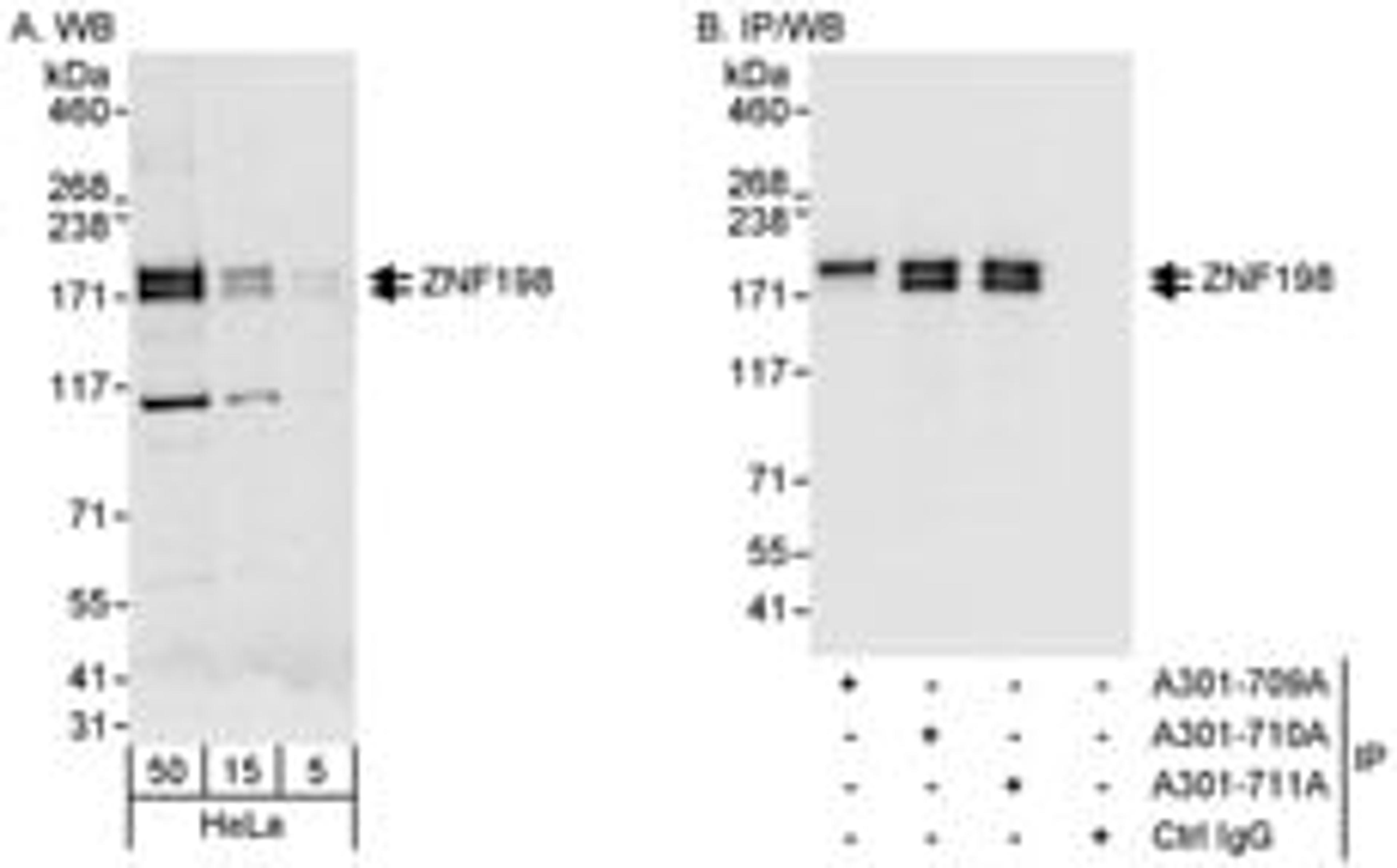 Detection of human ZNF198 by western blot and immunoprecipitation.