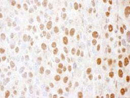 Detection of mouse SS-B by immunohistochemistry.