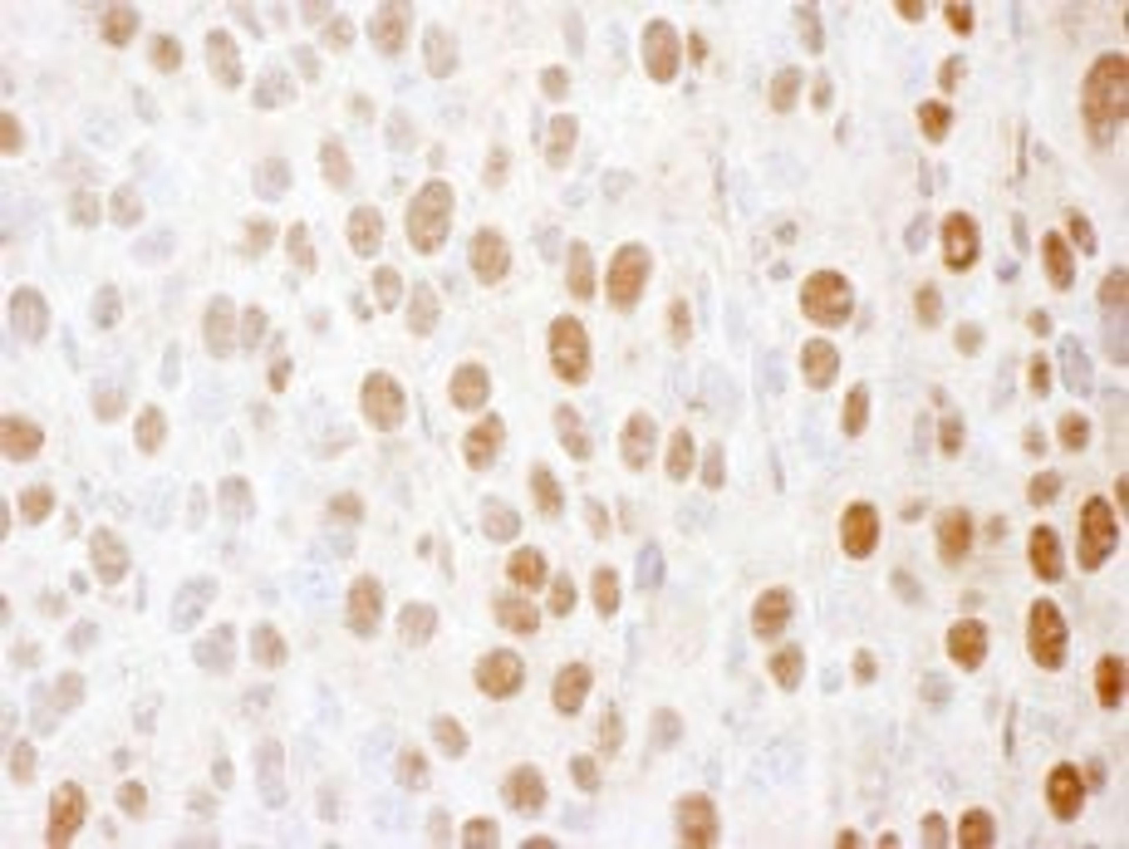 Detection of mouse SS-B by immunohistochemistry.