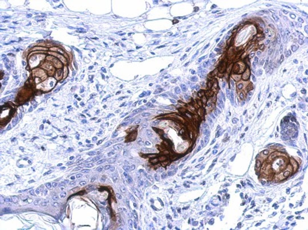 Immunohistochemistry-Paraffin: WDR19 Antibody [NBP2-20891] - Immunohistochemical analysis of paraffin-embedded Mahlarvu xenograft, using antibody at 1:500 dilution.