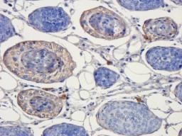 Immunohistochemical staining of rat skin tissue using anti-IL11 (dilution of primary antibody - 1:200)